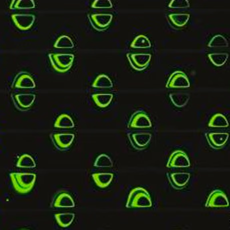 Inertial Microfluidics