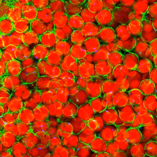 Smart Biomaterials